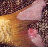 Bacteriën